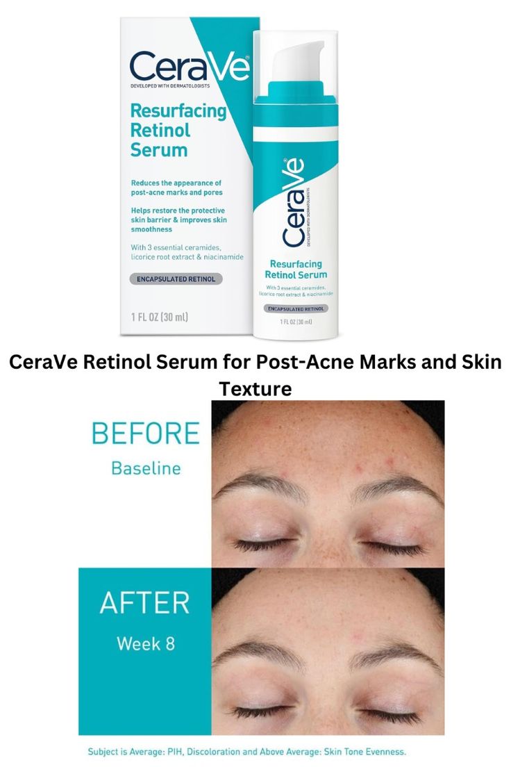 CeraVe Post-Acne Retinol Serum